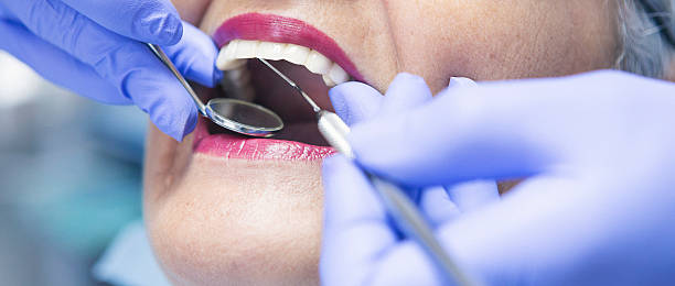 Best Emergency Dental Care for Broken or Chipped Teeth in Forsyth, MT
